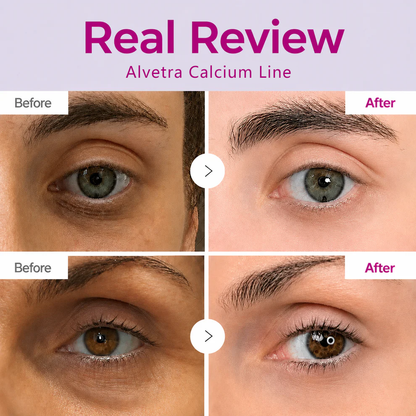 🔥LAST DAY 50% OFF!!Alvetra Korean Calcium Dark Spot Eye Cream