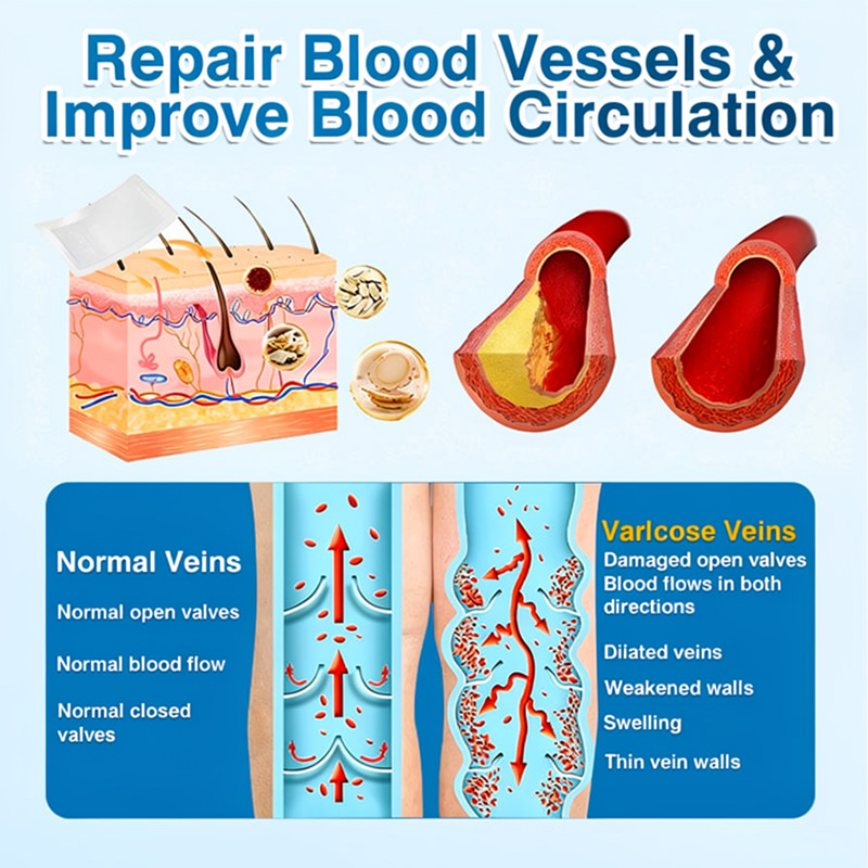 🇬🇧👨‍⚕️🌟🏅QIAWI® VeinRepair Microneedle Patch Roll⚡Instant Relief, Long-Term Results